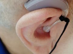 -自然之声助听器·呼吸机(翠微大厦店)