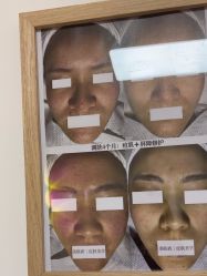 -美肤盾祛痘·问题肌头疗管理中心