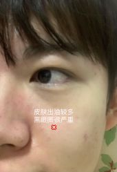 体验前-北京楚诺医疗美容