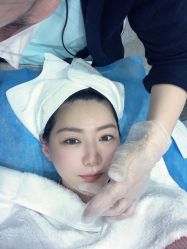 点击看大图 体验后-大连美天医疗美容医院