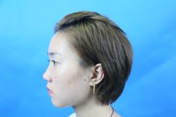 -安徽合肥韩美整形外科医院