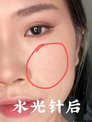 -上海漾颜医疗美容