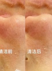 -SKIN79皮肤管理中心