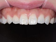 -新达口腔(华东理工大学店)