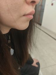 -长沙雅美医疗美容医院