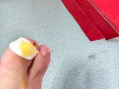 -新甲连锁灰指甲·甲沟炎·鸡眼(黑龙江路店)