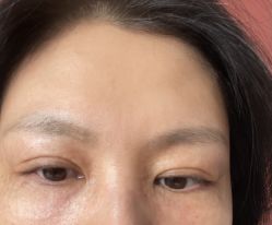 体验后-张小熊连锁轻医美