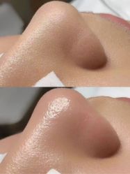 -美愈美肤MEIYU SKIN