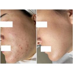 -美肤盾祛痘·问题肌头疗管理中心