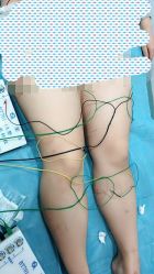 -摩瘦纤体订制减肥