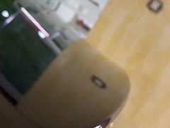 -鲨鱼皮汽车凹陷玻璃修复(静安店)