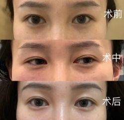 -上海漾颜医疗美容