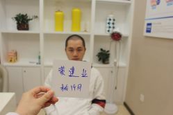 -大麦微针植发丨全国连锁