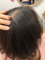 -髻尚坊增发补发织发假发定制