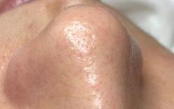 -悦肌YJ FOR FACE皮肤管理中心