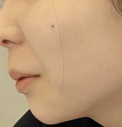 -长沙雅美医疗美容医院