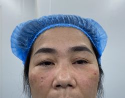 -天津健丽·去眼袋医疗美容机构