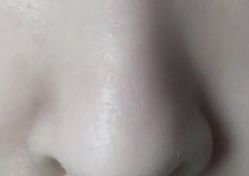 -正璞医疗美容·皮肤修复·微整注射
