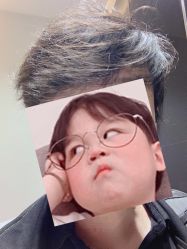 -大麦微针植发全国连锁