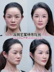 -深圳艺星医疗美容医院