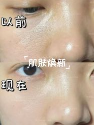 -彼家美创·量肤定制修护管理