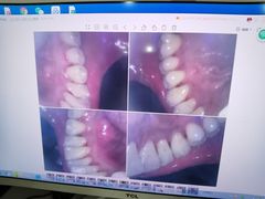 -同步齿科·数字化正畸种植口腔中心(前山店)