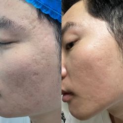 体验前-深圳美莱医疗美容医院