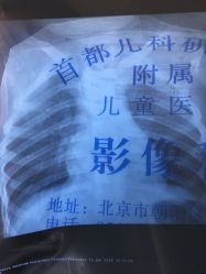 -首都儿科研究所附属儿童医院