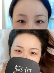 -Doris多里斯半永久纹眉·SMP纹发·发际线