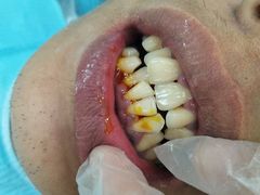 -微笑牙科口腔(三亚迎宾院区)