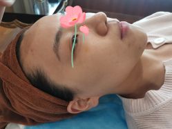 体验前-北京英煌医疗美容