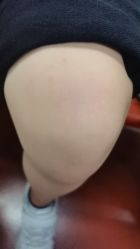 -复旦大学附属儿科医院
