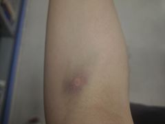 -瑞慈体检上海松江机构