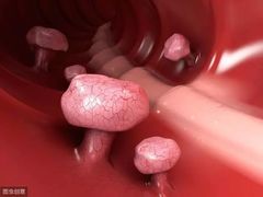 -热火朝天鲜切牛肉火锅(南强街巷店)