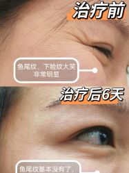 体验后-丽都整形美容医院·全国连锁旗舰店