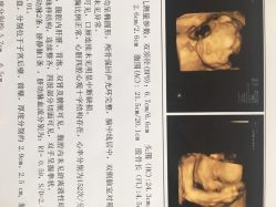点击看大图 -潍坊艾玛妇产医院