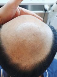 -极客侠男士假发定制补发