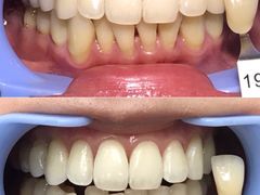 -Dr.Z dental仁康种植矫正中心