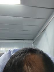 点击看大图 -大麦微针植发全国连锁