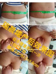 -瑞晨曦催乳产后健康(枣园店)