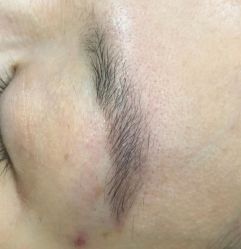 体验前-郡艺医疗美容·微整·眼鼻吸脂