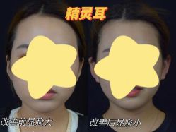 -Yestar重庆艺星医疗美容医院