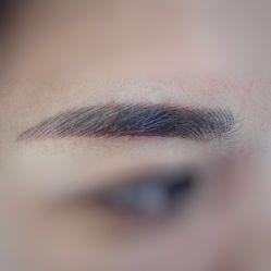 体验后-深圳美莱医疗美容医院