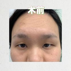 -素美医疗美容·西南眼鼻整形·修复基地