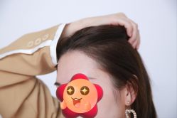 -大麦微针植发丨全国连锁