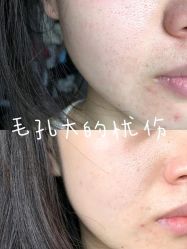 -铂诗玥医美