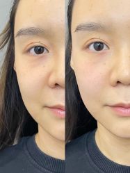 体验前-加减美医美连锁品牌