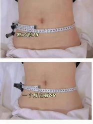 -Lily纤美·科技减脂中心