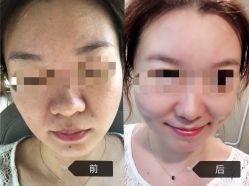 -圣嘉新医疗美容医院