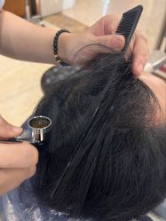 -大麦微针植发全国连锁
